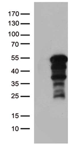 ZNF2 Monoclonal Antibody (OTI2A9), TrueMAB , OriGene:Antibodies:Primary