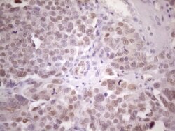 ZNF200 Monoclonal Antibody (OTI5F4), TrueMAB , OriGene 100 &mu;L; Unconjugated:Antibodies,
