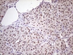 ZNF200 Monoclonal Antibody (OTI5F4), TrueMAB , OriGene 100 &mu;L; Unconjugated:Antibodies,