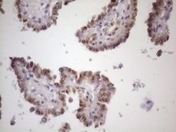 ZNF200 Monoclonal Antibody (OTI5F4), TrueMAB , OriGene 100 &mu;L; Unconjugated:Antibodies,