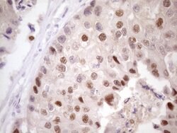 ZNF200 Monoclonal Antibody (OTI5F4), TrueMAB , OriGene:Antibodies:Primary