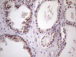 ZNF200 Monoclonal Antibody (OTI5F4), TrueMAB , OriGene:Antibodies:Primary