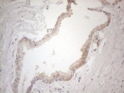 ZNF200 Monoclonal Antibody (OTI7C6), TrueMAB , OriGene 100 &mu;L; Unconjugated:Antibodies,
