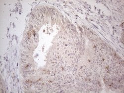 ZNF200 Monoclonal Antibody (OTI7C6), TrueMAB , OriGene:Antibodies:Primary
