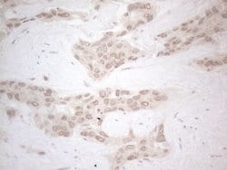 ZNF200 Monoclonal Antibody (OTI7C6), TrueMAB , OriGene 100 &mu;L; Unconjugated:Antibodies,