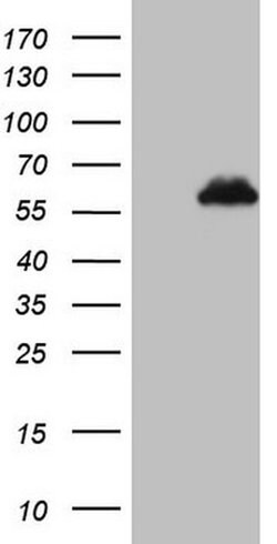 ZNF200 Monoclonal Antibody (OTI5F4), TrueMAB , OriGene 100 &mu;L; Unconjugated:Antibodies,