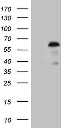 ZNF200 Monoclonal Antibody (OTI7C6), TrueMAB , OriGene 100 &mu;L; Unconjugated:Antibodies,