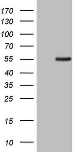 ZNF200 Monoclonal Antibody (OTI3B6), TrueMAB , OriGene 30 &mu;L | Buy Online | Origene Technologies | Fisher Scientific