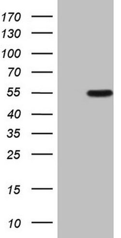ZNF200 Monoclonal Antibody (OTI1F3), TrueMAB , OriGene 30 &mu;L; Unconjugated:Antibodies,