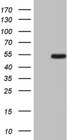 ZNF200 Monoclonal Antibody (OTI6F10), TrueMAB , OriGene:Antibodies:Primary