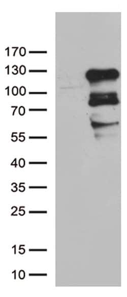 ZNF202 Mouse anti-Human, Clone: OTI1D12, lyophilized, TrueMAB 100 &mu;g;