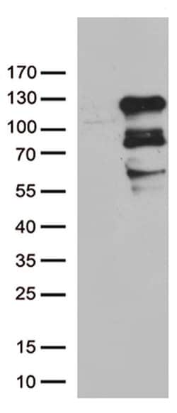 ZNF202 Monoclonal Antibody (OTI1D12), TrueMAB , OriGene 100 &mu;L; Unconjugated:Antibodies,