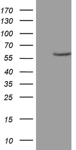 ZNF213 Mouse anti-Human, Clone: OTI1A12, lyophilized, TrueMAB 100 &mu;g;