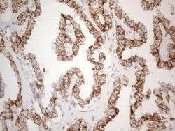 ZNF217 Mouse anti-Human, Clone: OTI2B4, lyophilized, TrueMAB 100 &mu;g;