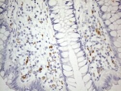 ZNF217 Mouse anti-Human, Clone: OTI2B4, lyophilized, TrueMAB 100 &mu;g;