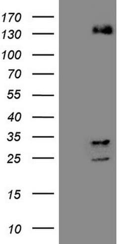 ZNF217 Monoclonal Antibody (OTI1G8), TrueMAB , OriGene 100 &mu;L; Unconjugated:Antibodies,