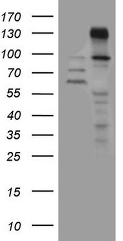 ZNF217 Mouse anti-Human, Clone: OTI2B4, lyophilized, TrueMAB 100 &mu;g;