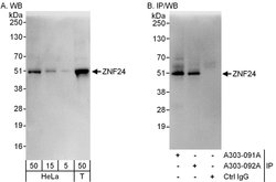 ZNF24 Rabbit anti-Human, Polyclonal, Bethyl Laboratories 100 &mu;L; Unconjugated:Antibodies,