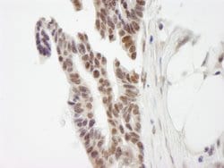 ZNF261 Polyclonal Antibody, Bethyl Laboratories:Antibodies:Primary Antibodies