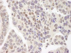 ZNF261 Polyclonal Antibody, Bethyl Laboratories 10 &mu;l; Unlabeled:Antibodies,