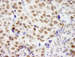 ZNF261 Polyclonal Antibody, Bethyl Laboratories 10 &mu;l; Unlabeled:Antibodies,
