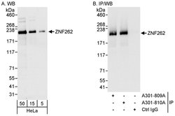ZNF262 Rabbit anti-Human, Polyclonal, Bethyl Laboratories 100 &mu;L; Unconjugated:Antibodies,