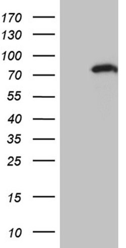 ZNF264 Monoclonal Antibody (OTI2A6), TrueMAB , OriGene 100 &mu;L | Buy Online | OriGene | Fisher Scientific