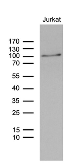 ZNF264 Mouse anti-Human, Clone: OTI2A6, lyophilized, TrueMAB 100 &mu;g;