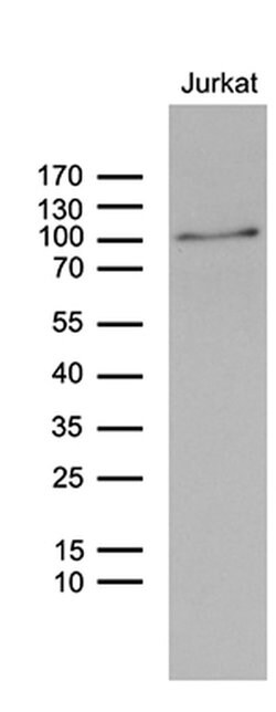 ZNF264 Monoclonal Antibody (OTI2A6), TrueMAB , OriGene 100 &mu;L | Buy Online | OriGene | Fisher Scientific