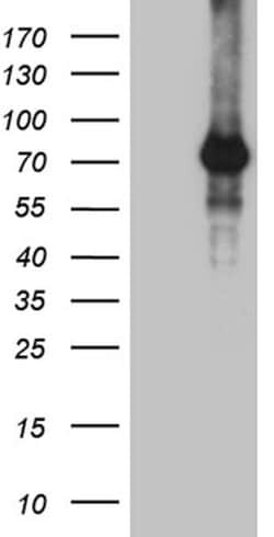 ZNF264 Monoclonal Antibody (OTI8G5), TrueMAB , OriGene 100 &mu;L; Unconjugated:Antibodies,