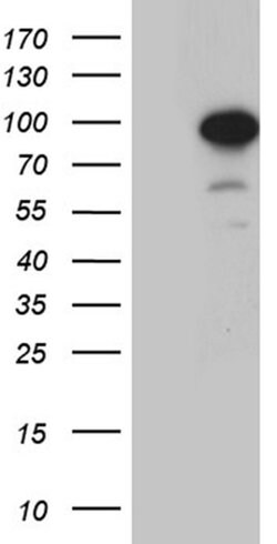 ZNF264 Monoclonal Antibody (OTI8E9), TrueMAB , OriGene 100 &mu;L; Unconjugated:Antibodies,