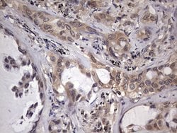 ZNF286A Monoclonal Antibody (OTI7D2), TrueMAB , OriGene 100 &mu;L; Unconjugated:Antibodies,