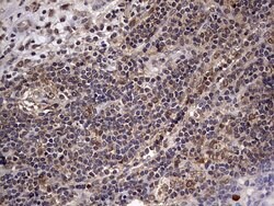 ZNF286A Monoclonal Antibody (OTI7D2), TrueMAB , OriGene 100 &mu;L; Unconjugated:Antibodies,