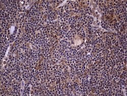 ZNF286A Monoclonal Antibody (OTI7D2), TrueMAB , OriGene 100 &mu;L; Unconjugated:Antibodies,