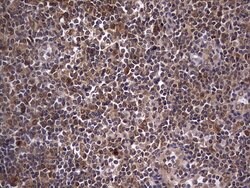 ZNF286A Monoclonal Antibody (OTI7D2), TrueMAB , OriGene 100 &mu;L; Unconjugated:Antibodies,