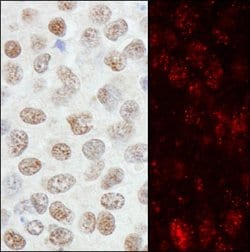 ZNF295 Rabbit anti-Human, Polyclonal, Bethyl Laboratories 100 &mu;L; Unconjugated:Antibodies,