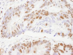 ZNF295 Polyclonal Antibody, Bethyl Laboratories:Antibodies:Primary Antibodies