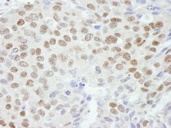 ZNF295 Polyclonal Antibody, Bethyl Laboratories 100 &mu;L; Unconjugated:Antibodies,