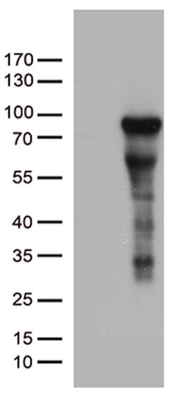 ZNF317 Mouse anti-Human, Clone: OTI10C5, lyophilized, TrueMAB 100 &mu;g;