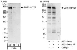 ZNF318/TZF Rabbit anti-Human, Polyclonal, Bethyl Laboratories 100 &mu;L;