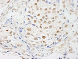 ZNF318/TZF Polyclonal Antibody, Bethyl Laboratories 10 &mu;l; Unlabeled:Antibodies,