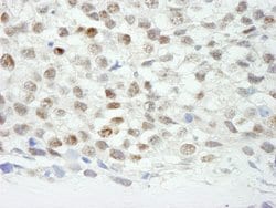 ZNF318/TZF Polyclonal Antibody, Bethyl Laboratories 10 &mu;l; Unlabeled:Antibodies,