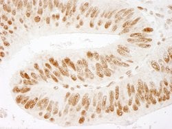 ZNF326 Polyclonal Antibody, Bethyl Laboratories:Antibodies:Primary Antibodies
