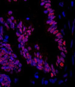 ZNF326 Polyclonal Antibody, Bethyl Laboratories 10 &mu;L; Unconjugated:Antibodies,