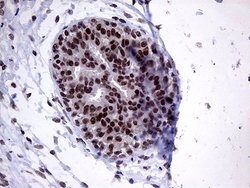 ZNF329 Monoclonal Antibody (OTI2B11), TrueMAB , OriGene:Antibodies:Primary