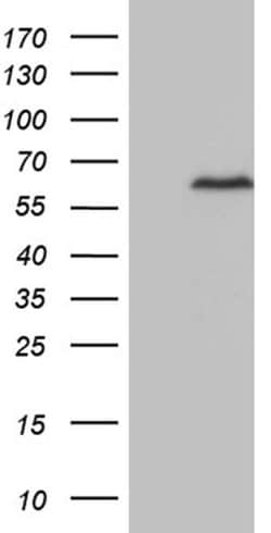 ZNF329 Monoclonal Antibody (OTI2F3), TrueMAB , OriGene 100 &mu;L; Unconjugated:Antibodies,