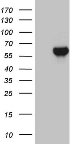 ZNF329 Monoclonal Antibody (OTI6B12), TrueMAB , OriGene:Antibodies:Primary