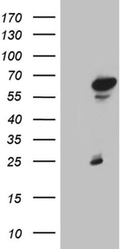 ZNF329 Monoclonal Antibody (OTI2D6), TrueMAB , OriGene:Antibodies:Primary