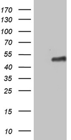 ZNF330 Monoclonal Antibody (OTI8E9), TrueMAB , OriGene:Antibodies:Primary