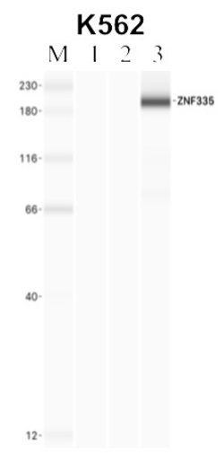 Invitrogen ZNF335 Polyclonal Antibody 100 &mu;L; Unconjugated:Antibodies,